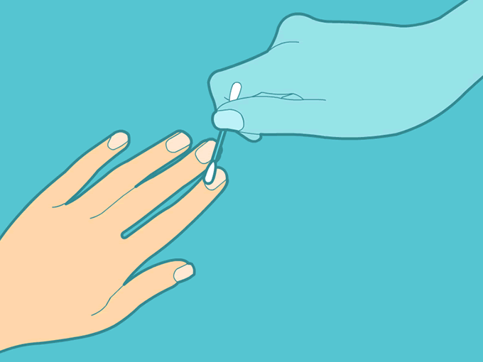 Cuticles